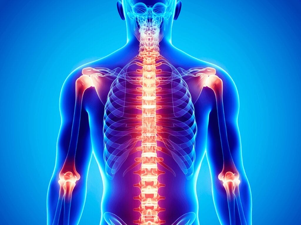 Inflammation